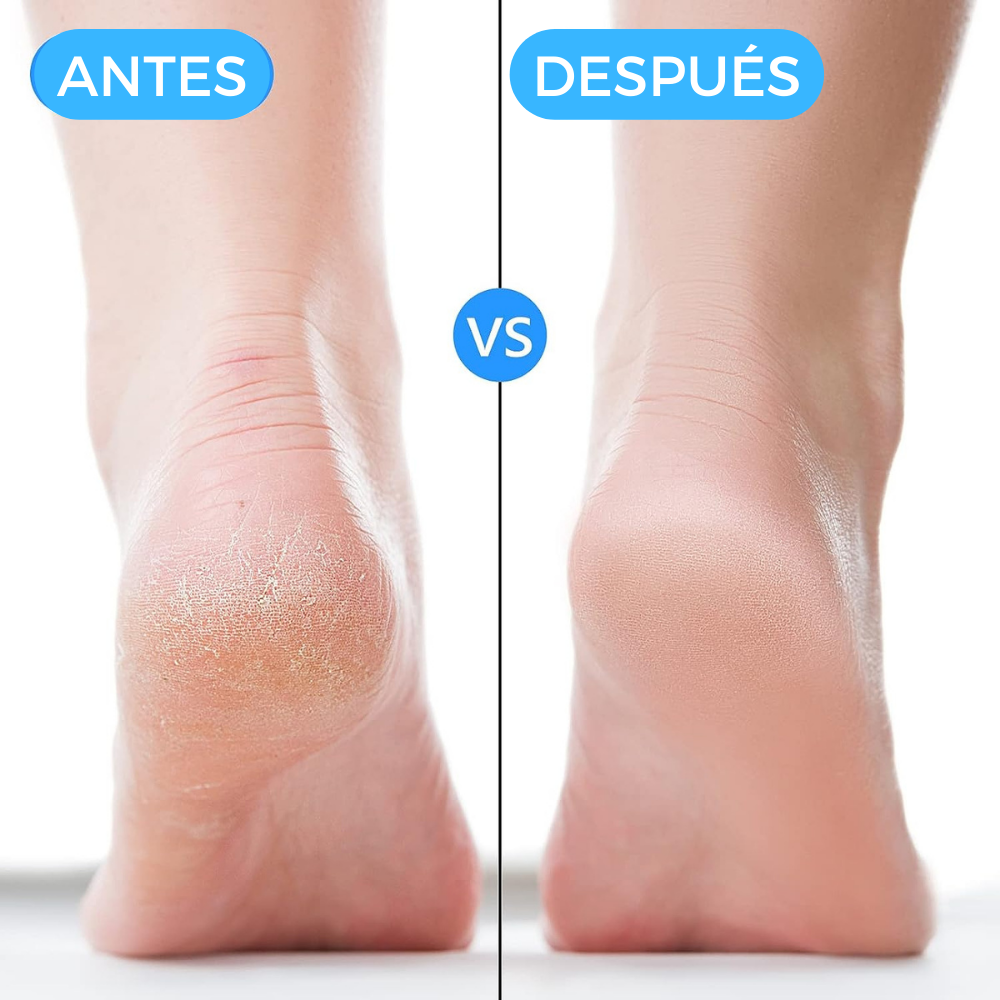 Par adicional Taloneras terapéuticas transpirables - PharmaToe™